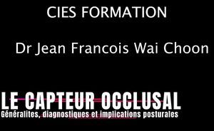 Le capteur occlusal DR WAI CHOON